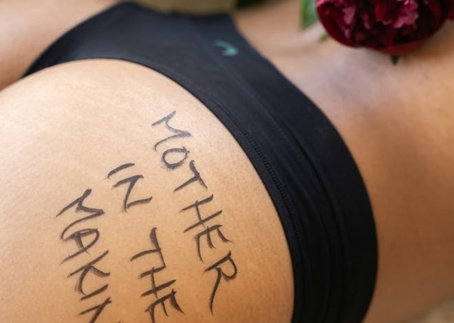 How to Get Rid of Stretch Marks After Working Out
