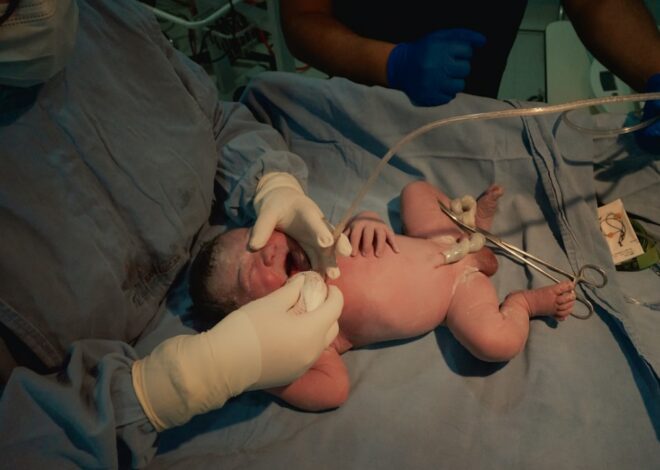 Process of Umbilical Cord Blood Donation
