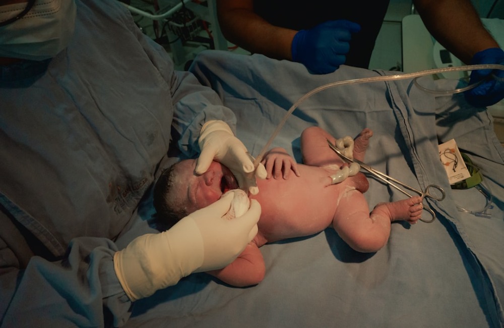 Process of Umbilical Cord Blood Donation