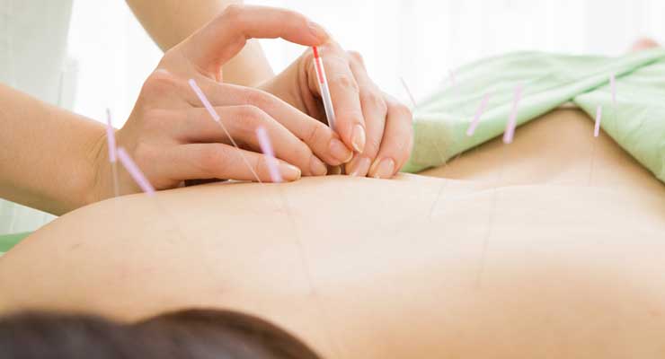 Acupuncture for Fertility