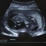 Organ Development During Pregnancy