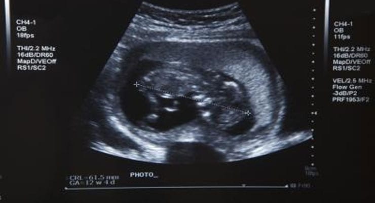 Organ Development During Pregnancy