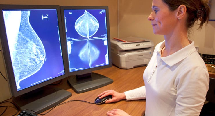 How Many Women Are Diagnosed With Breast Cancer Each Year?