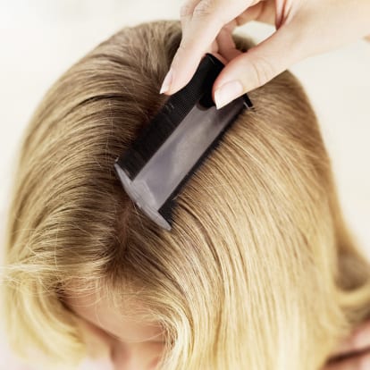 How to Effectively Treat Head Lice