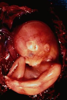 Fetal Development at 10 Weeks Pregnant
