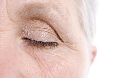 Treatments for Under Eye Wrinkles
