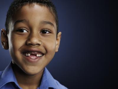 Children & Loose Teeth