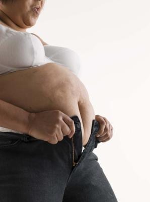 Obese Pregnancy Support - ModernMom