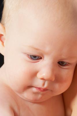 Head Injury Symptoms in Babies