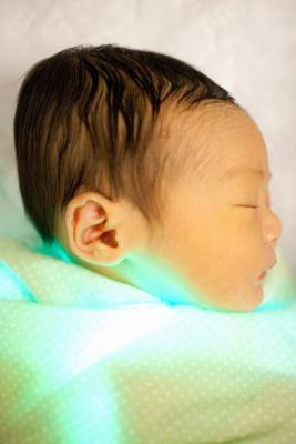 Babies With Jaundice