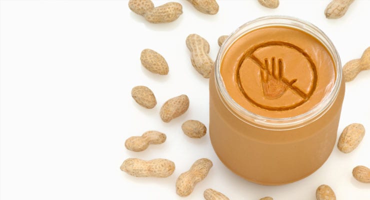 Deadly Food Allergies: From A Teen Who Has Them