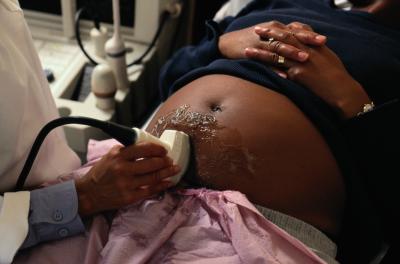 3-D Ultrasounds During Pregnancy