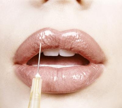 Botox for Wrinkles on the Lips