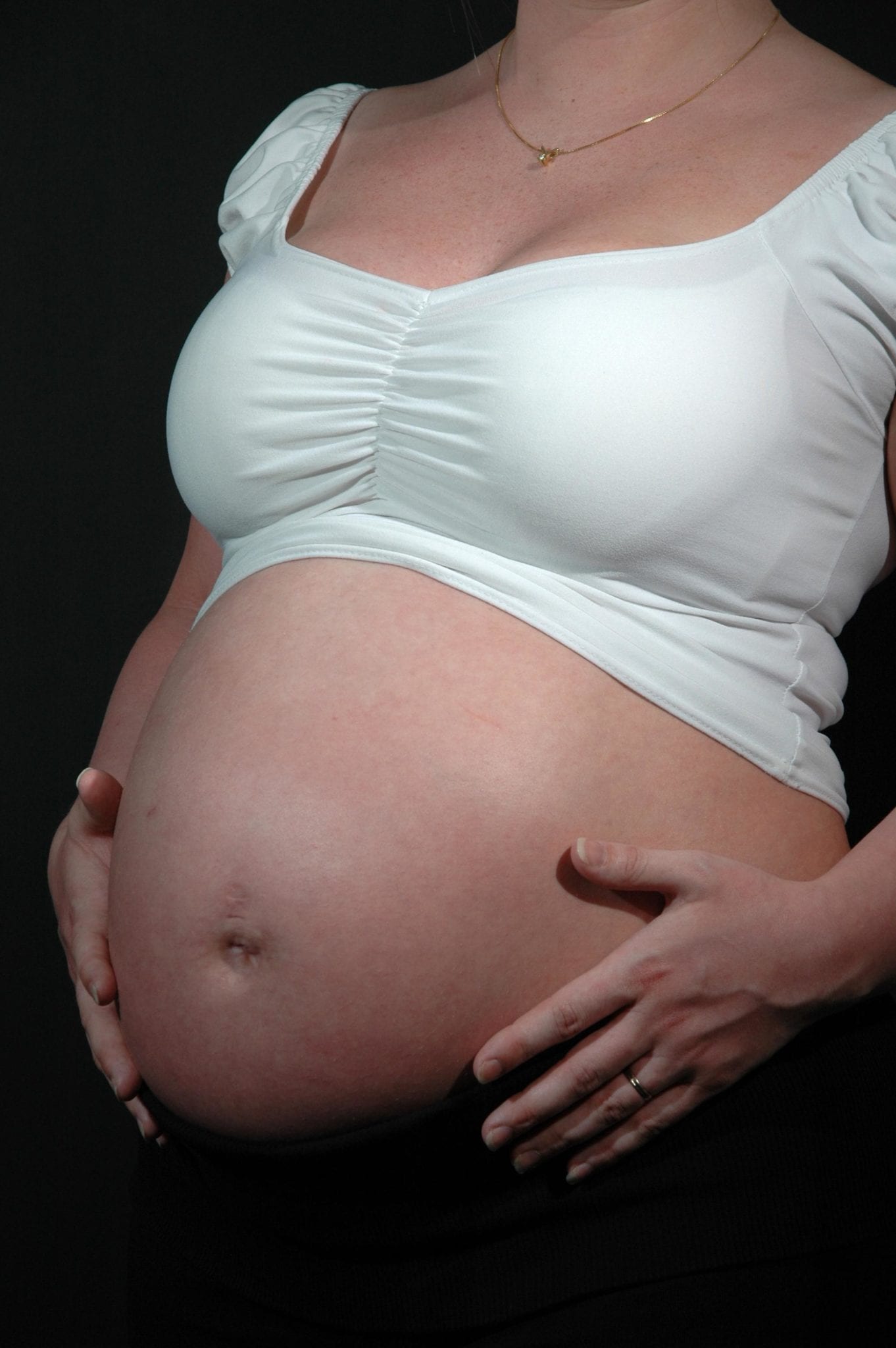 Avoiding Stretch Marks When Pregnant