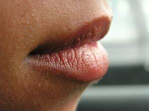 How to Get Fuller Lips