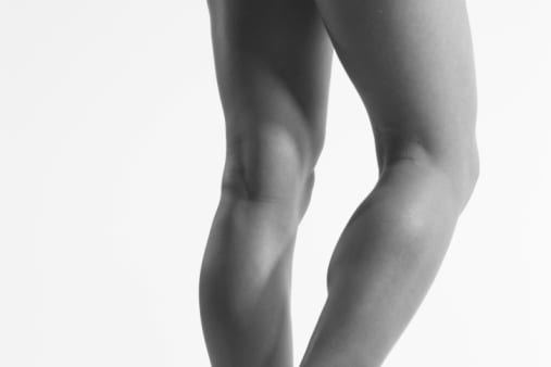 4 Ways to Cure Varicose Veins