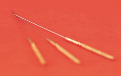 Benefits of Acupuncture