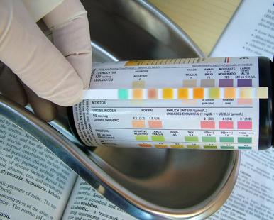 Signs of Toxemia in Pregnancy