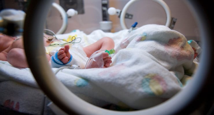 10 Things To Know If You Have A Premature Baby