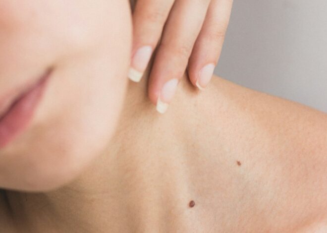 One of Skin Cancer’s Hidden Spots