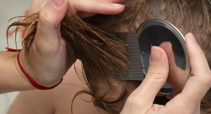 Cures Remedies For Head Lice Modern Mom